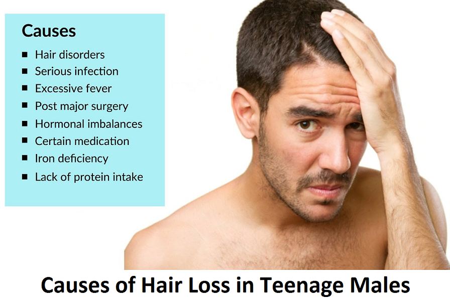 causes of hair loss in teenage males