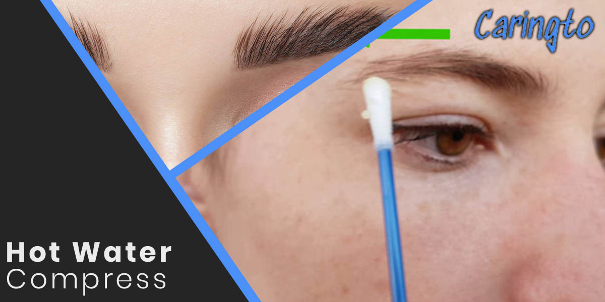 Hot Water Compress Treatment