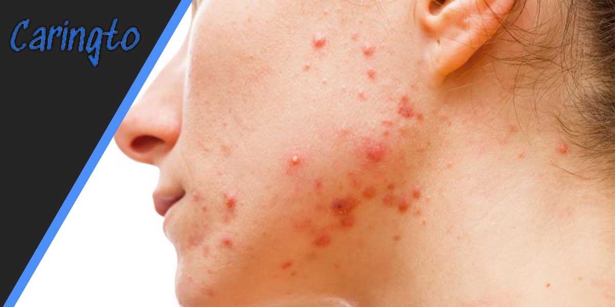 How to Use H&S for Better Results?