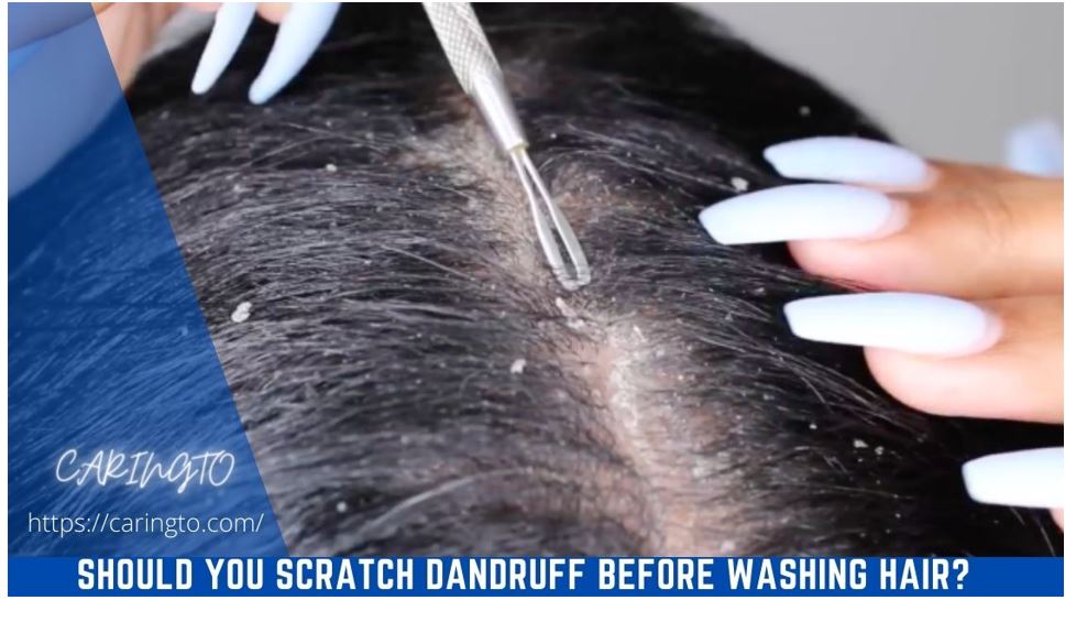 Should You Scratch Dandruff Before Washing Hair?