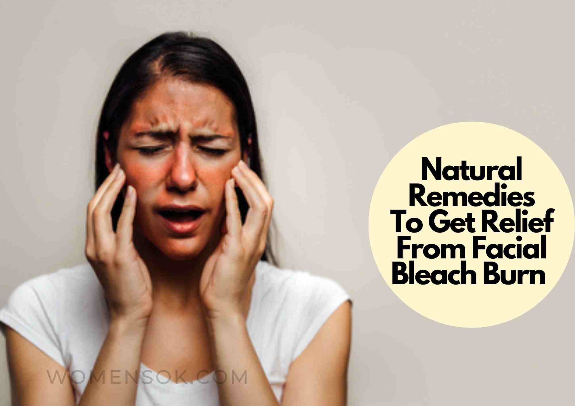 8 Natural Remedies To Get Relief From Facial Bleach Burn | Soothing Tips For Relieving Bleach Irriation