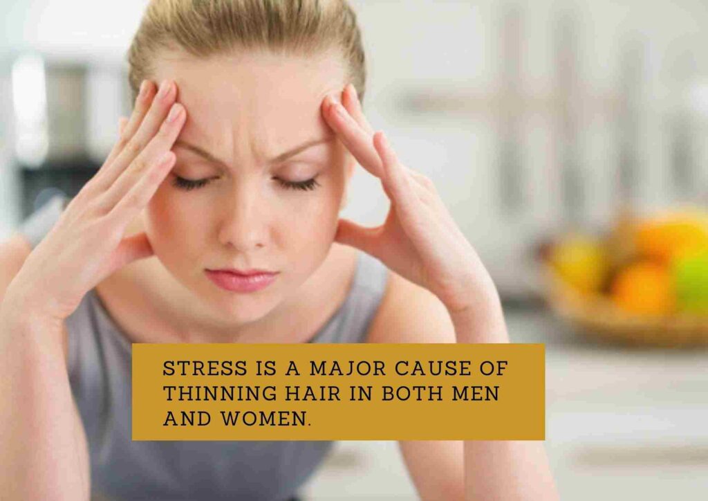 
thinning hair on top of head female