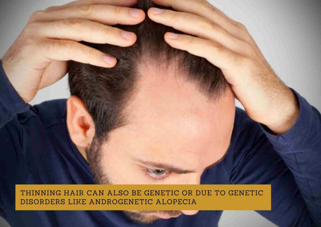 
my hair is thinning male