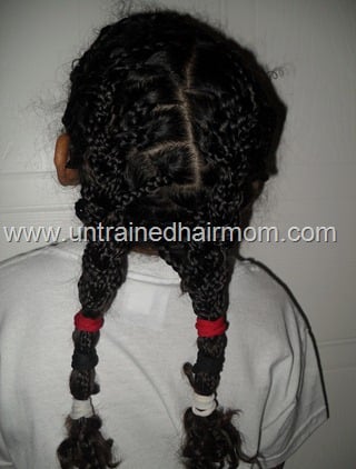 How To Get Rid Of Stretch Mark on Butt | 22 Things To Reduce Stretch Marks on Butt!