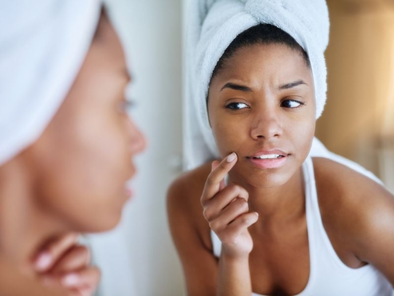 Can facial scrubs cause breakouts