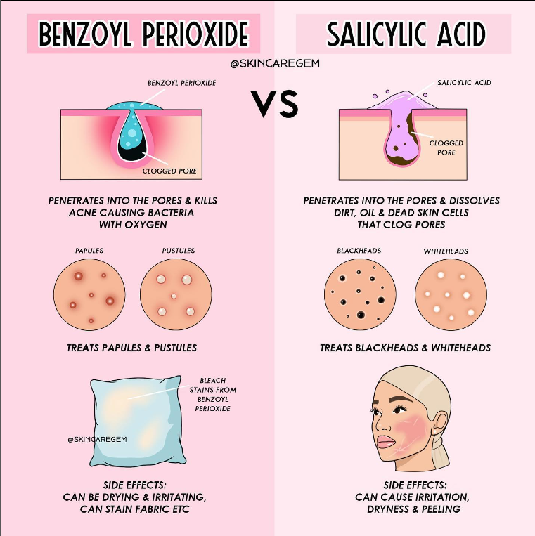 what do i use on face for zits