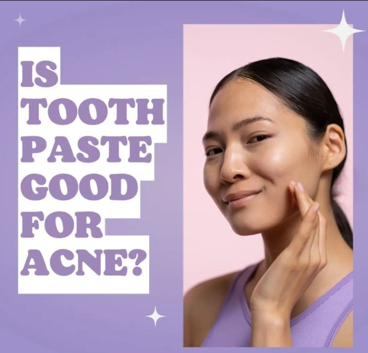 toothpaste on pimples remedy