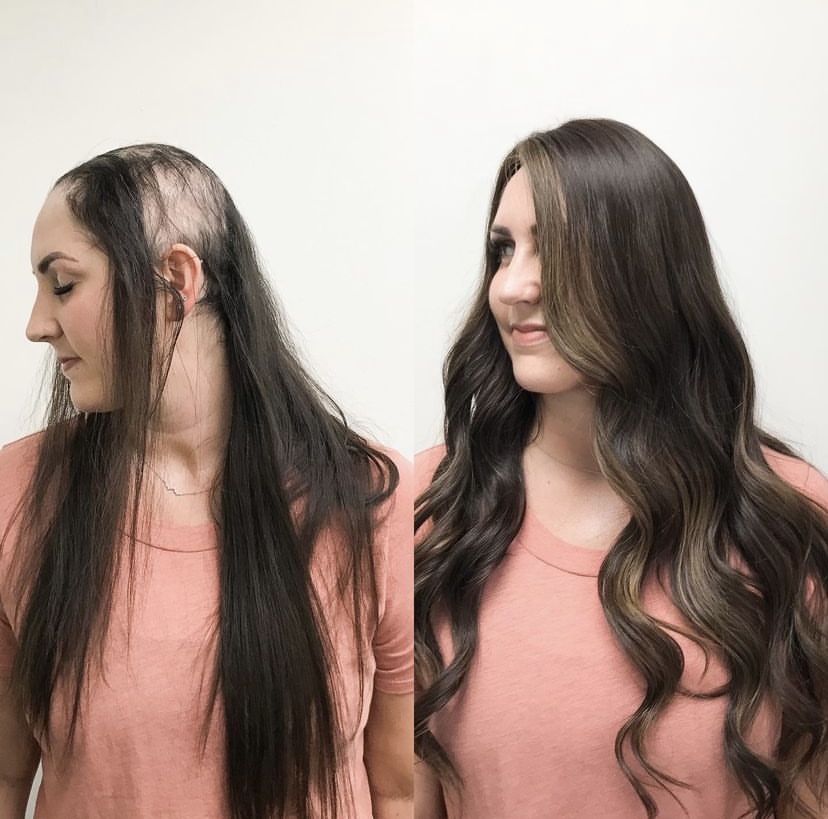 Why Does My Hair Grow on One Side More Than the Other?