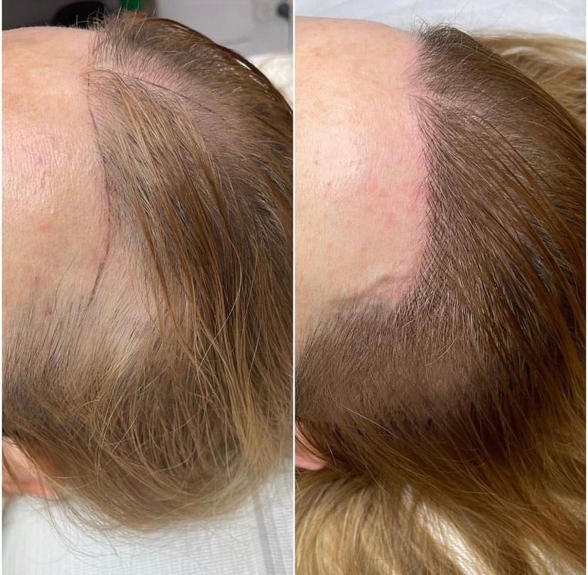 Why Does My Hair Grow on One Side More Than the Other?