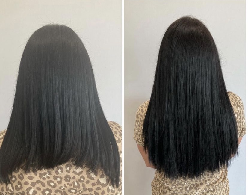 Why Does My Hair Grow on One Side More Than the Other?