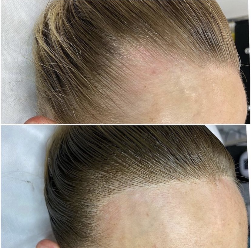 Why Does My Hair Grow on One Side More Than the Other?