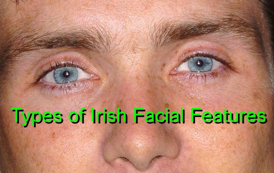 What Are Typical Irish Facial Features?