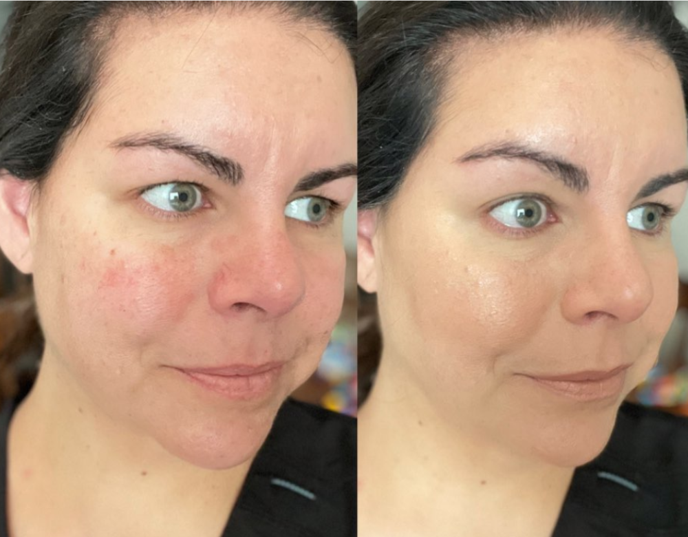 does bb cream give better coverage than cc