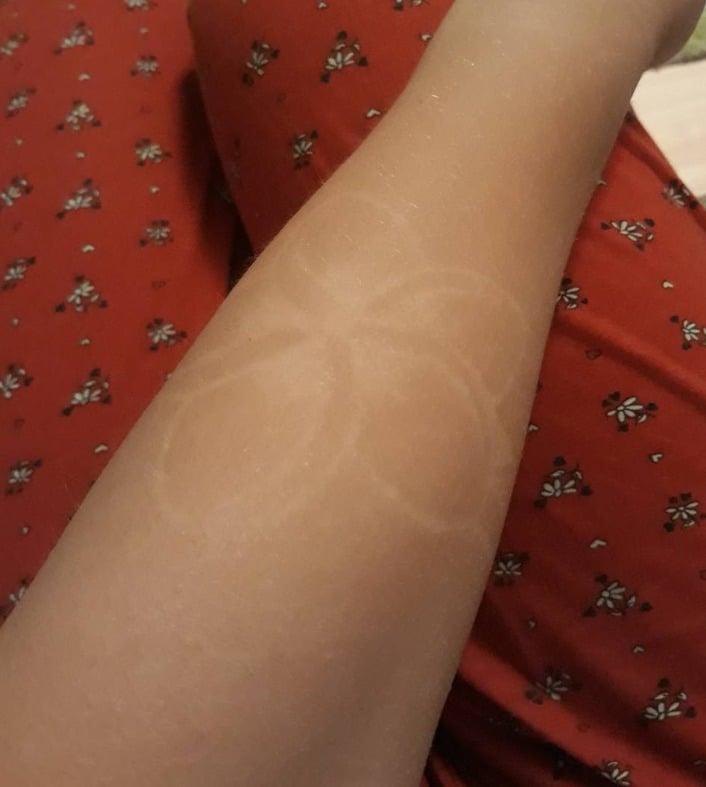 Do Temporary Tattoos Leave Tan Lines?