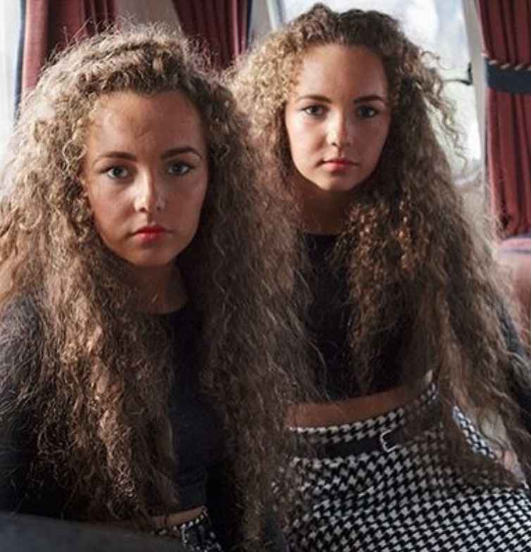 irish traveller facial features